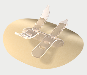 BX/30 CATHGRIP PEG PROTECT, NO ALCOHOL WIPE, STERILE - BILINGUAL