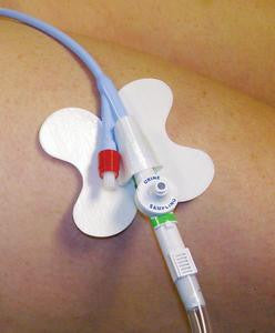 MCJ 54456 EA/1 CATH-SECURE MULTI-PURPOSE TUBE HOLDER 2 1/2IN WRAP TAB, BUTTERFLY BASE