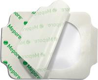 MOL 273000 BX/10 MEPORE FILM DRESSING, SIZE 15CM X 21.5CM