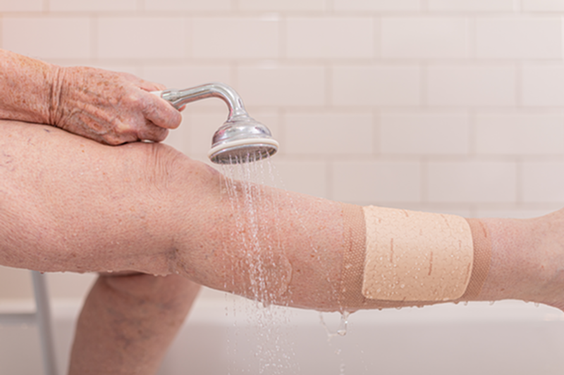 MOL 595611 BX/10 MEPILEX BORDER FLEX 15 X20CM (6 X8")