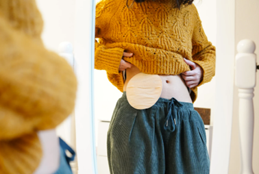 Temporary vs Permanent Stoma: A Simple Guide for Canadians Living With an Ostomy