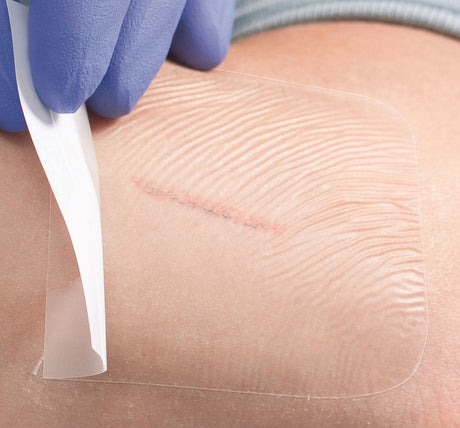 Transparent Film Dressing application