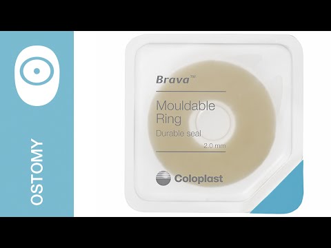 Moldable Ostomy Rings: Crafting Comfort for Ostomates