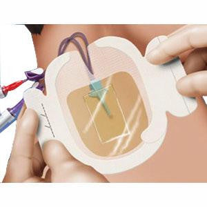 3M 1657 BX/25 TEGADERM CHG IV SECUREMENT DRESSING, SIZE 8.5CM X 11.5CM